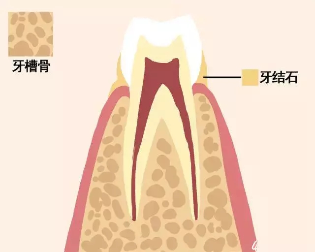 老掉牙！真的吗？(图3)