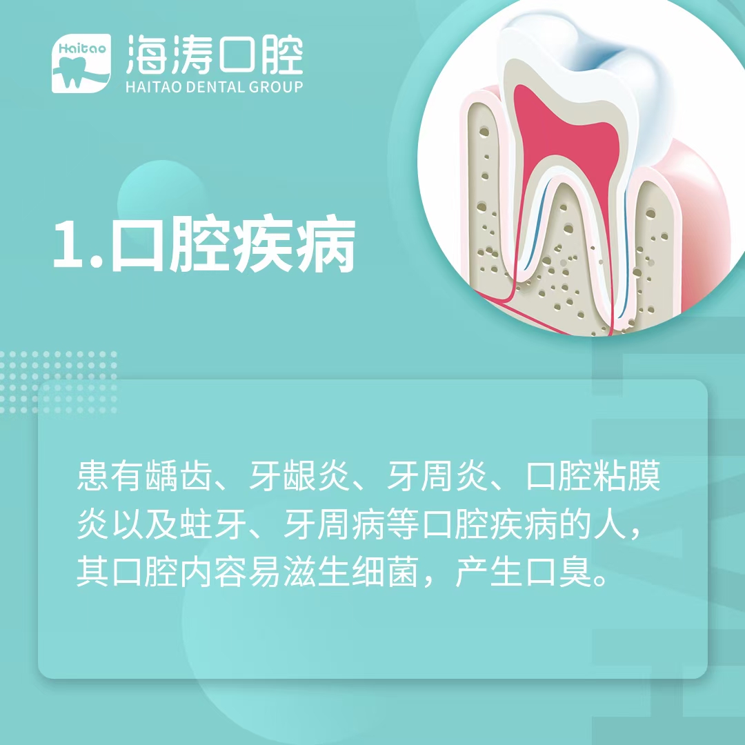 口臭！好烦恼(图1)