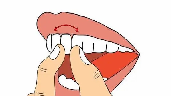 牙松到什么程度要拔牙？拔牙后旁边的牙齿会不会松(图1)