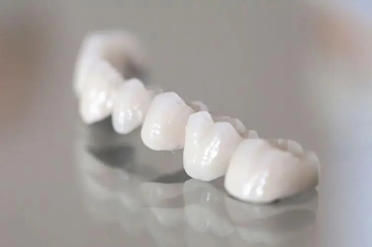 牙齿黄做烤瓷牙好还是贴面好？哪个性价比高一些？(图1)