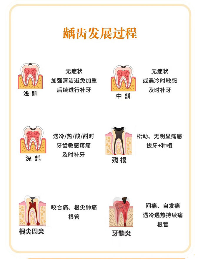 小洞不补，大洞吃苦！龋齿问题真的不能忽视(图1)