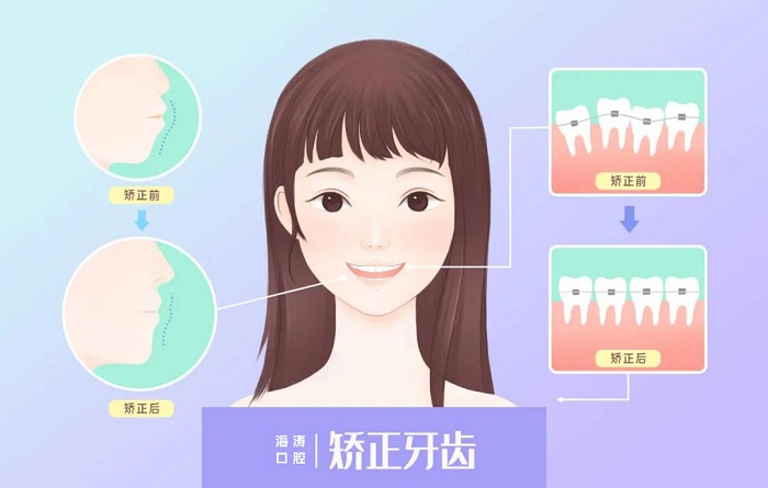 这个寒假 正是矫正好时节
