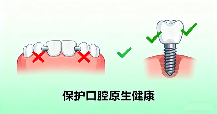 种植牙优势有那些？